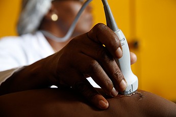 Ultrasound and maternity care imaging